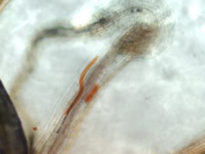 Stained root-lesion nematode and its egg inside roots of Big bluestem grass.